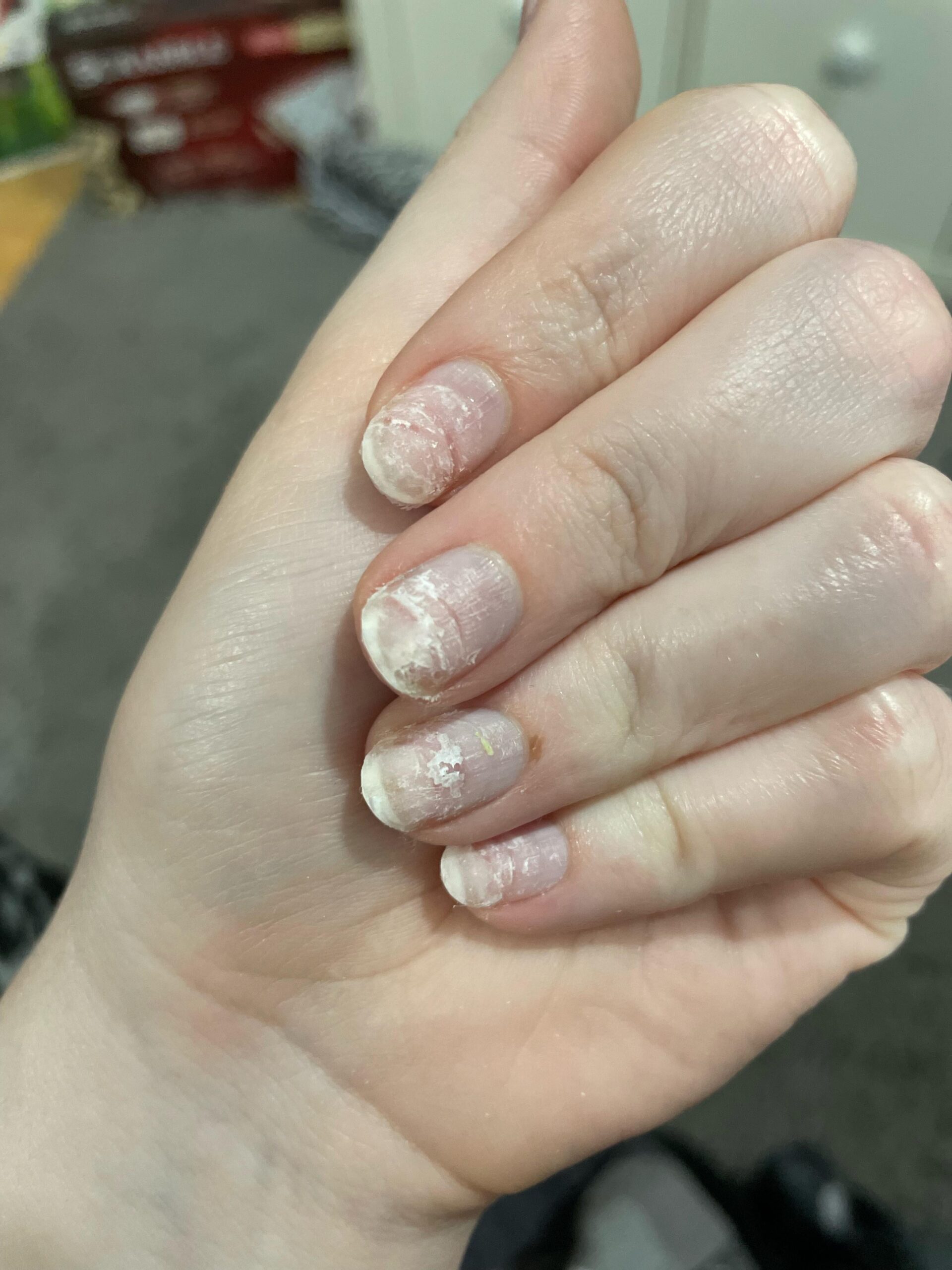 Acrylic Nails